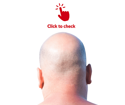 bald-head_vocabulary-exercise