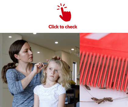 head-lice-vocabulary-exercise